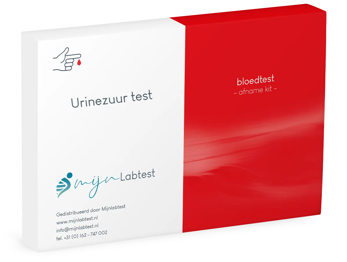 Test d'acide urique