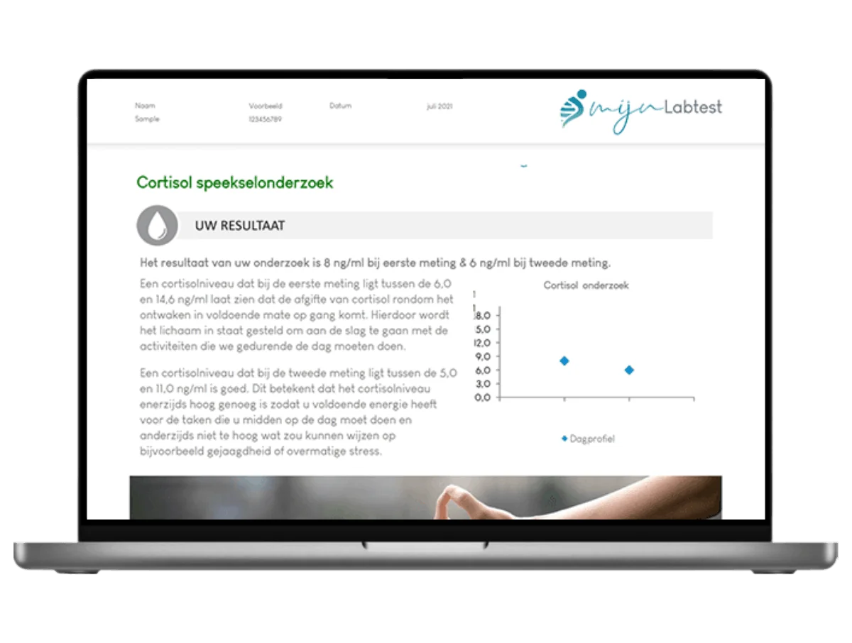 Exemple de résultat du bilan cortisol + DHEA sur un ordinateur portable