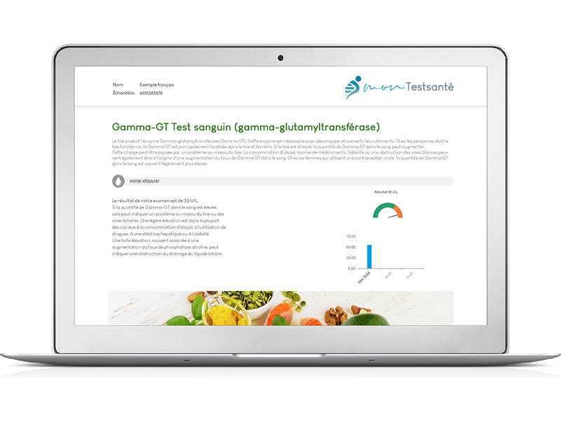 Gamma GT test uitslag