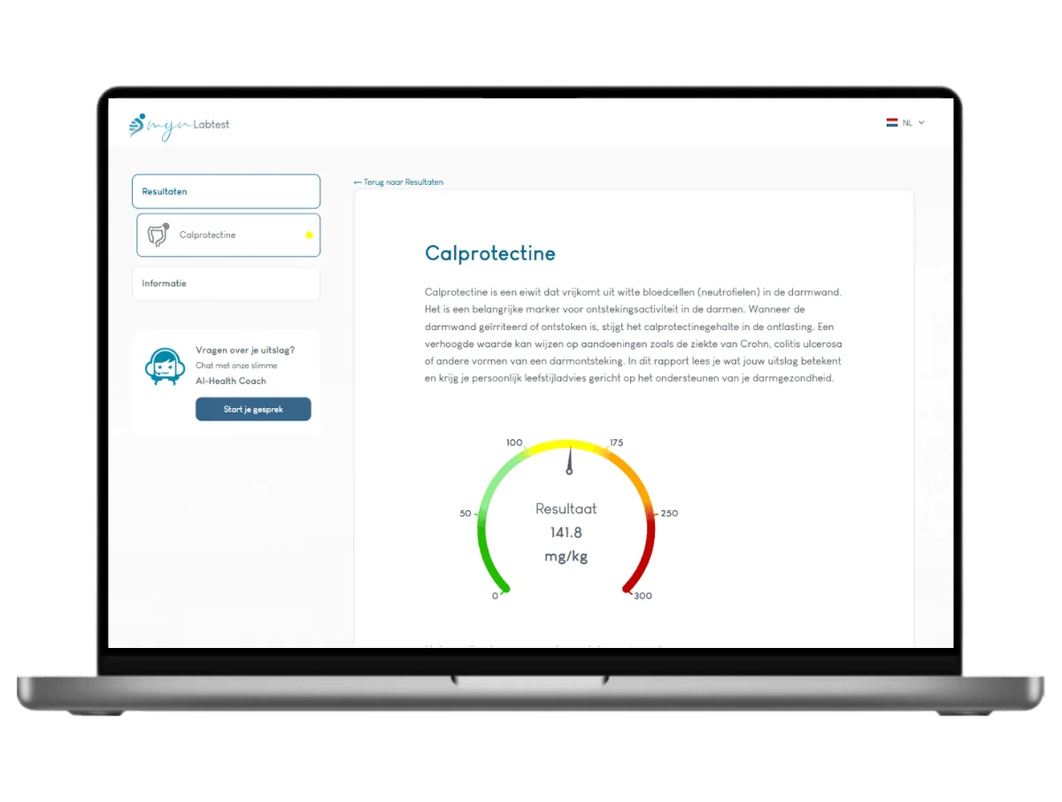 Exemple de résultat d'un test de calprotectine sur un ordinateur portable