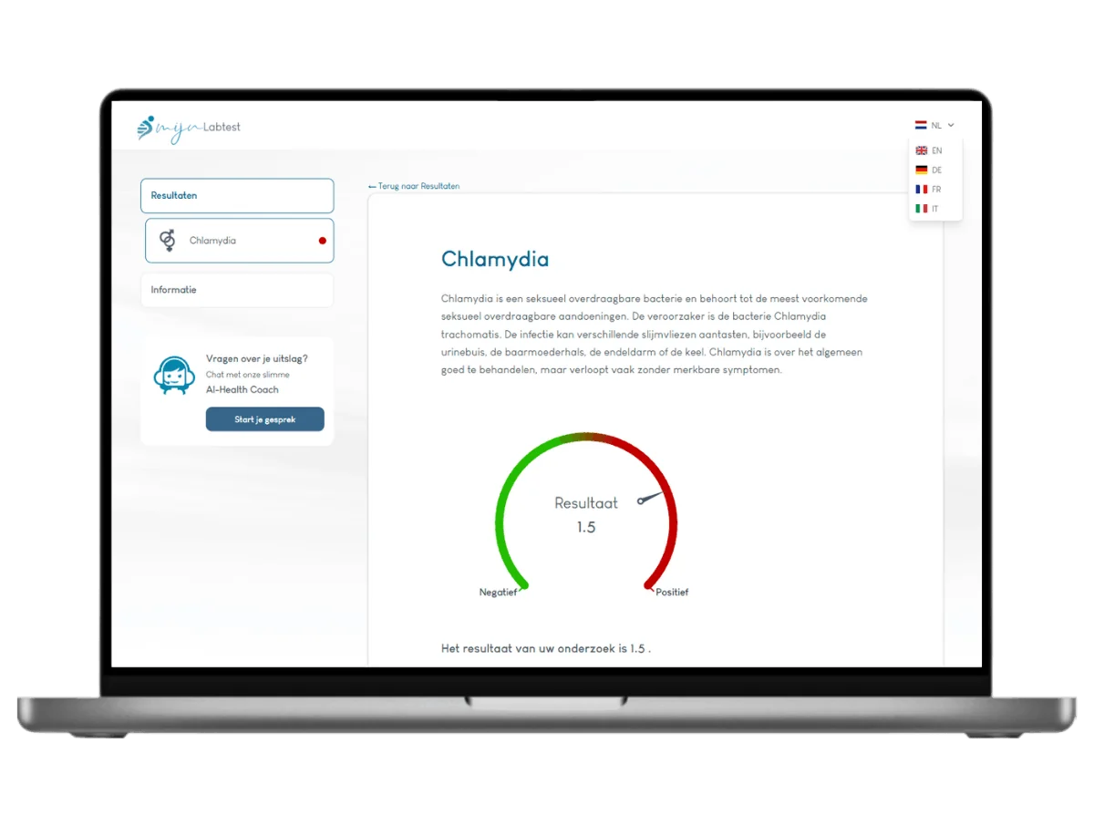 Exemple de résultat du test de la chlamydia sur un ordinateur portable