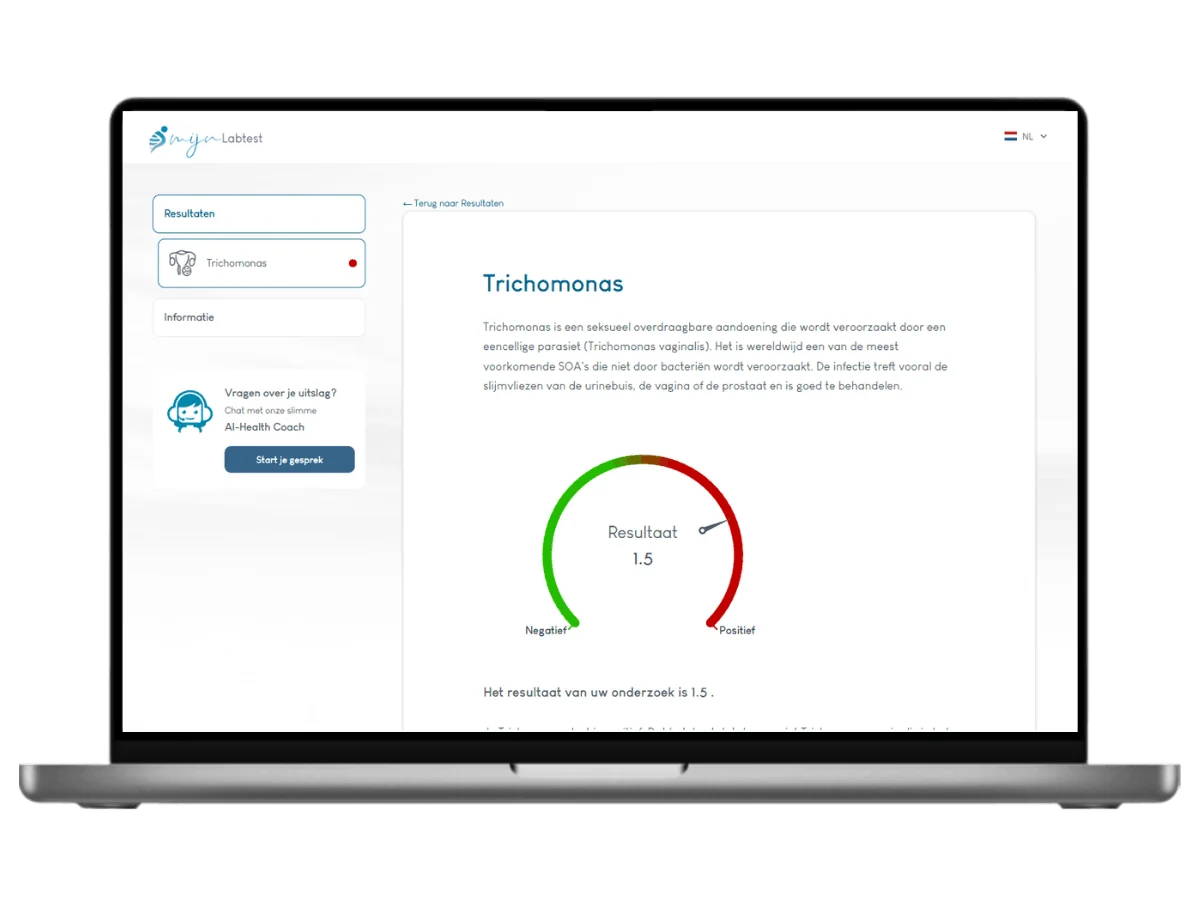 Exemple de résultat du test de dépistage du Trichomonas sur un ordinateur portable