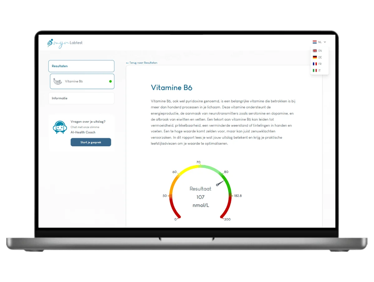 Exemple de résultat du test de la vitamine B6 sur un ordinateur portable