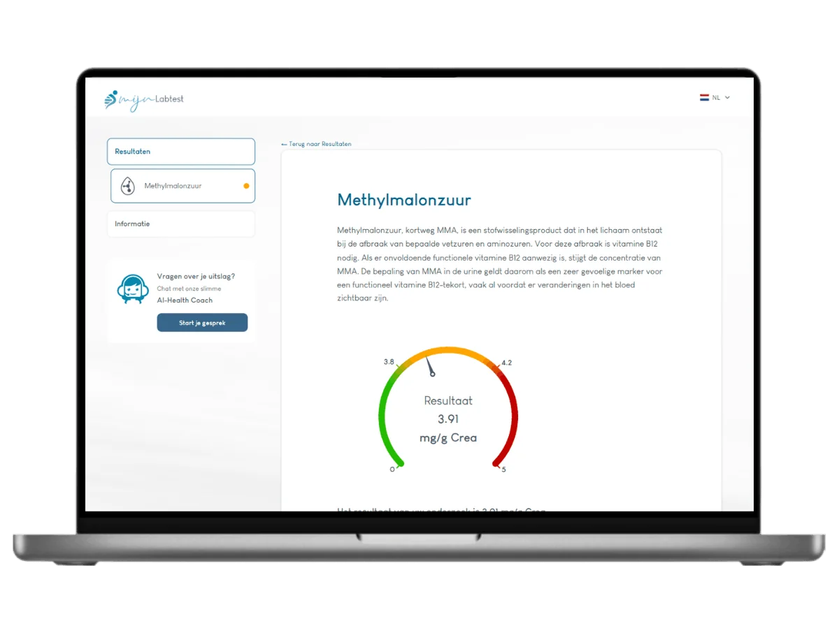 Exemple de résultat du test de l'acide méthylmalonique (MMA) affiché sur un ordinateur portable