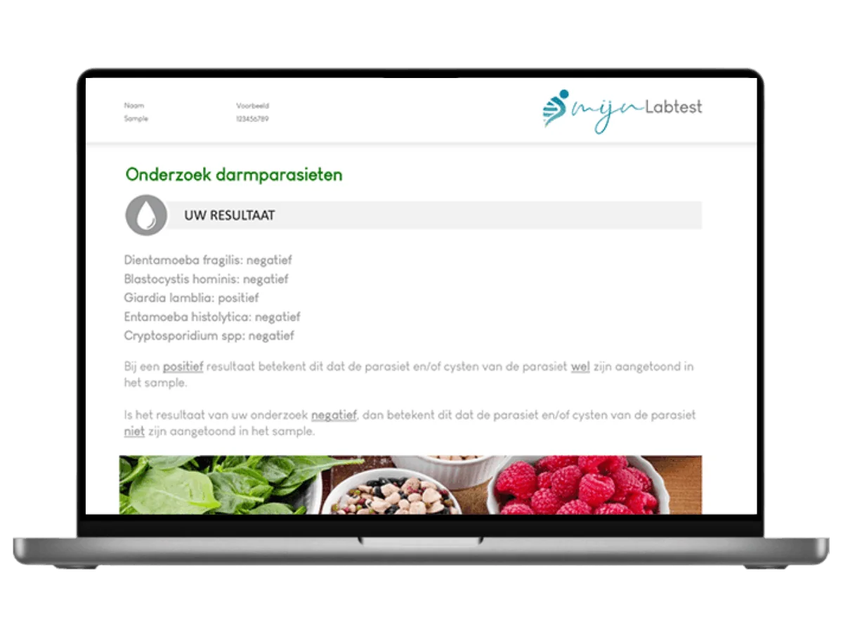 Exemple de résultat du test de dépistage de Cryptosporidium spp. sur un ordinateur portable