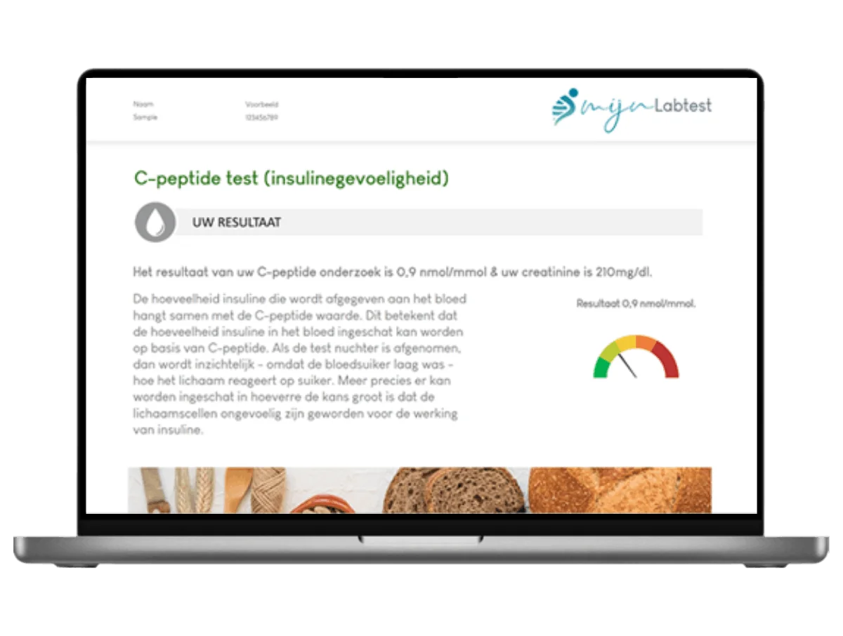 Exemple de résultat du test du peptide C sur un ordinateur portable