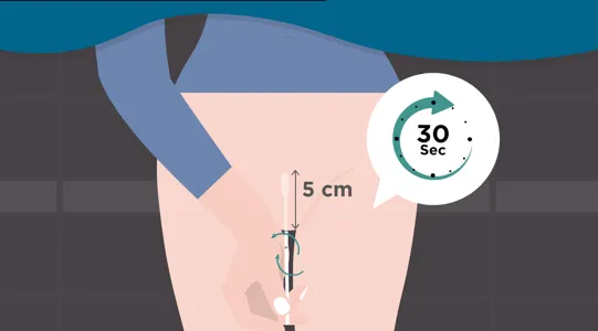 Faites votre test de dépistage du Trichomonas chez vous