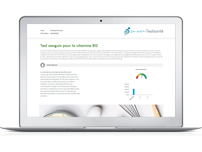 Vitamine B12 test uitslag