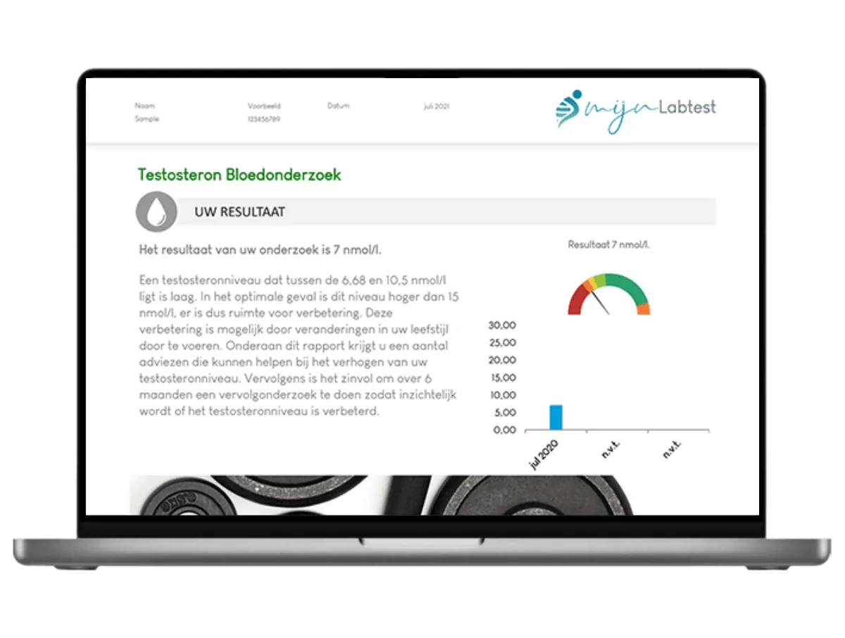 Exemple de résultat du test de testostérone libre sur un ordinateur portable