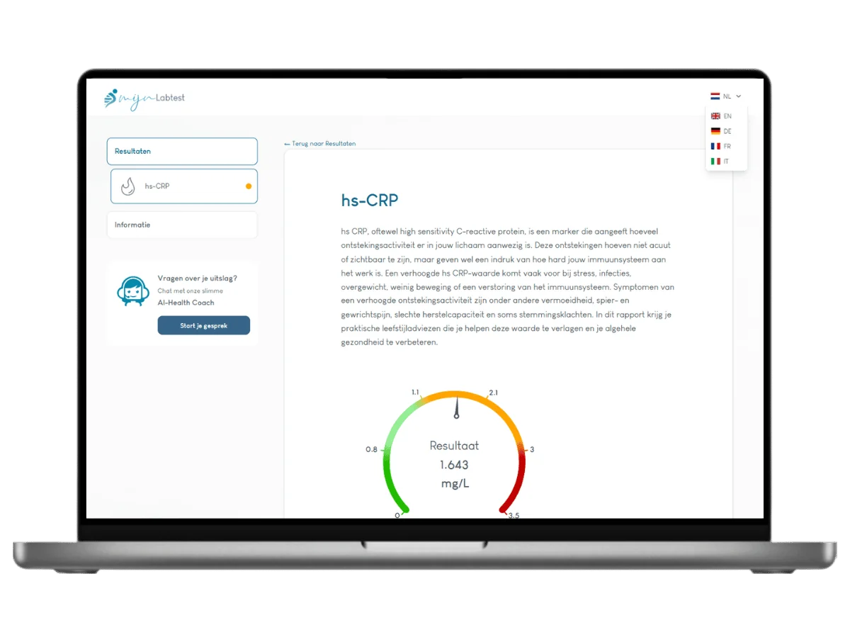 Exemple de résultat du test CRP sur un ordinateur portable