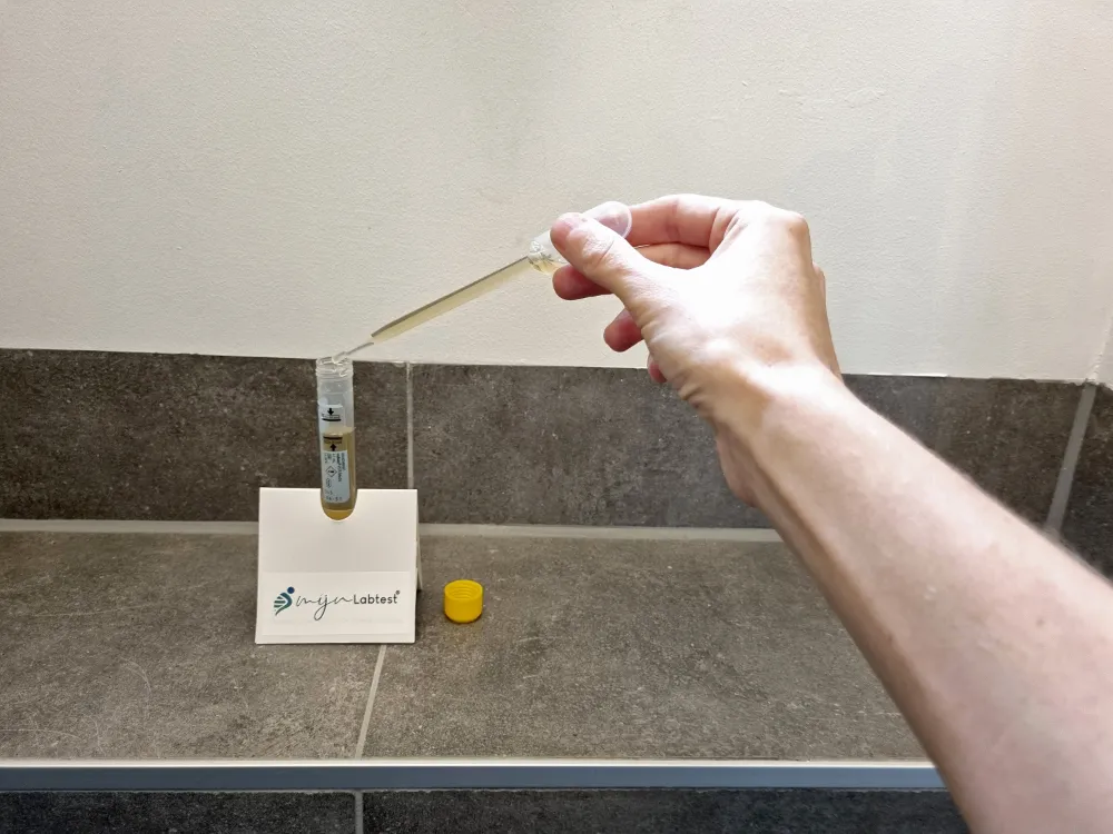 Réalisez votre auto-prélèvement IST à la maison, urine ou écouvillon